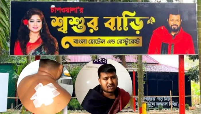 ওমর সানীর রেস্তোরাঁয় কাস্টমারকে কুপিয়ে জখম